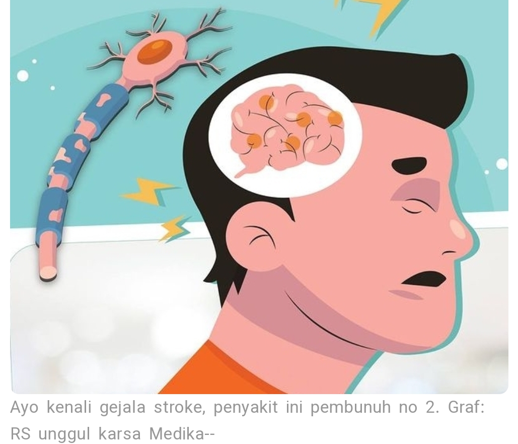 Mitos dan Fakta tentang Stroke 