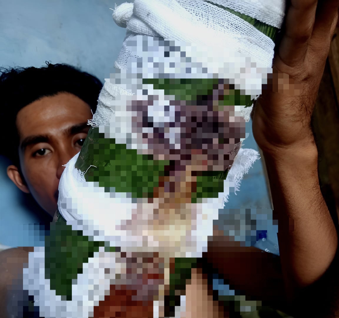 Cerita Pilu Eks dan Karyawan PT Autumn Agro Industri di Palas